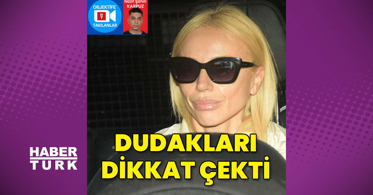 Gülşen’in dudakları dikkat çekti