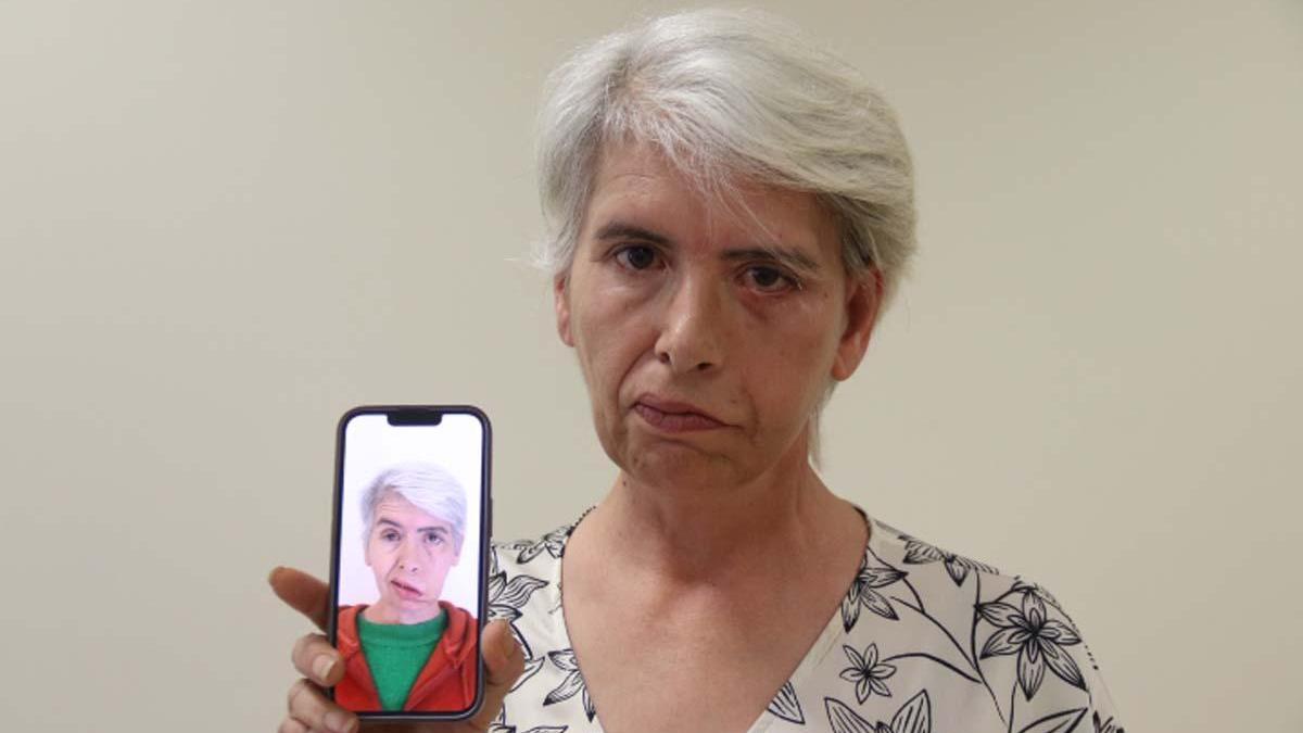 41 yıldır gözleri açık uyuyordu! Gözüne takılan 24 ayar altın implantla sağlığına kavuştu